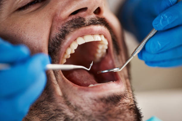 Best Emergency Root Canal Treatment in Knoxville, TN