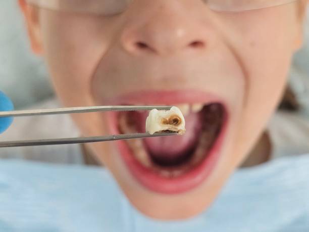 Best Emergency Dental Care for Trauma or Injury in Knoxville, TN